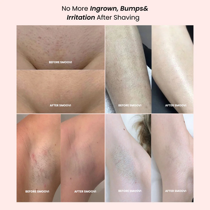 Smoovi 2.0 Bikini Shaver