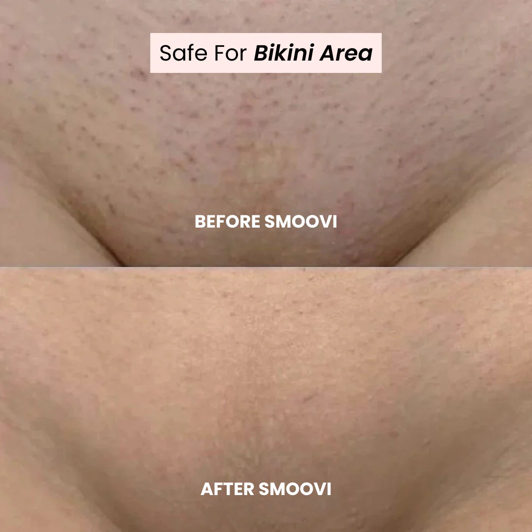 Smoovi 2.0 Bikini Shaver