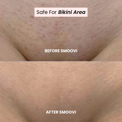Smoovi 2.0 Bikini Shaver